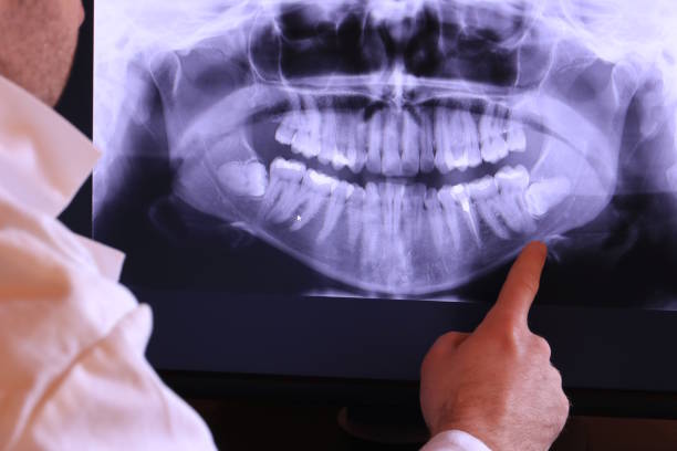 Best Emergency Treatment for Dental Infections or Abscesses in Charles City, IA